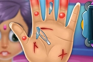 Hand Doctor En hånd med sår, splinter og rødme, set forfra med pincet, og en sløret figur i baggrunden