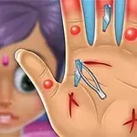 Hand Doctor En hånd med sår, splinter og rødme, set forfra med pincet, og en sløret figur i baggrunden